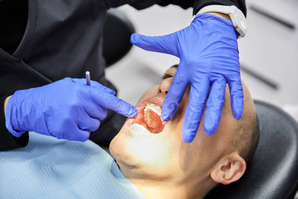 Best Tooth Infection Emergency Dentist  in University, FL